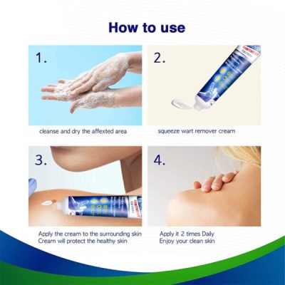 Wart Remover Cream,mole removal cream,Blemish Removal Cream,Instant Blemish Removal Cream