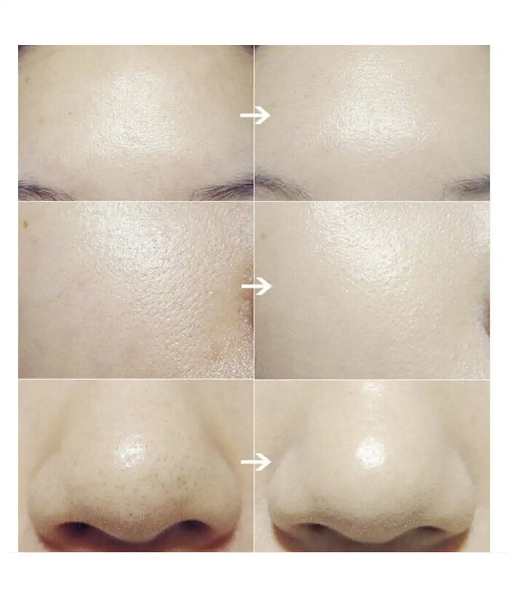 Facial Cleansing Brush - Image 5