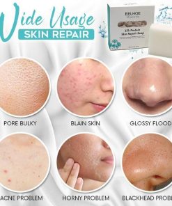 Skin Repair Soap,Skin Repair,Repair Soap,Silk-Protein
