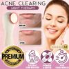 Acne Clearing Light Therapy