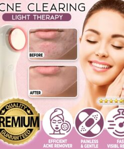 Acne Clearing Light Therapy