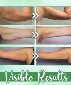 Care Patch,Armpit Fat Removal Lymph Patch,Lymphatic Armpit and Arm Care Patch,Arm Care Patch,Fat Removal