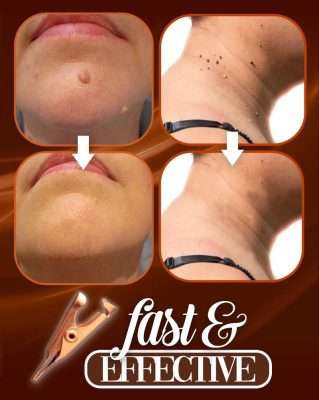 Tag Away Copper Clip Set,Copper Clip Set,Clip Set,Tag Away Copper