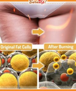 Cellulite Heating Spray,Cellulite Melting Spray,Heating Spray,Cellulite Heating,BurnUp!