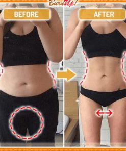 Cellulite Heating Spray,Cellulite Melting Spray,Heating Spray,Cellulite Heating,BurnUp!