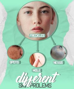 Spot Removal,Plasma Laser Pen,Laser Pen,Spot Removal Pen