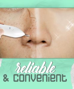 Spot Removal,Plasma Laser Pen,Laser Pen,Spot Removal Pen