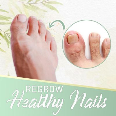 Nail Fungus Instant Treatment Gel,Nail Fungus,Instant Treatment,Treatment Gel,gel