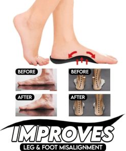Orthopedic Insoles,Flat Foot Orthopedic,Foot Orthopedic,Flat Foot