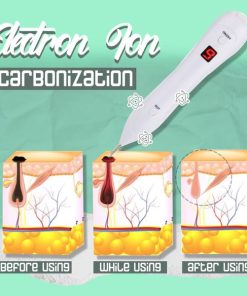 Spot Removal,Plasma Laser Pen,Laser Pen,Spot Removal Pen