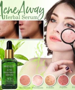 Herbal Serum,Acne Away,Serum