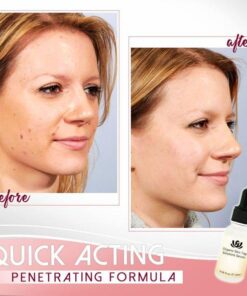 Organic Blemish Purifying Serum