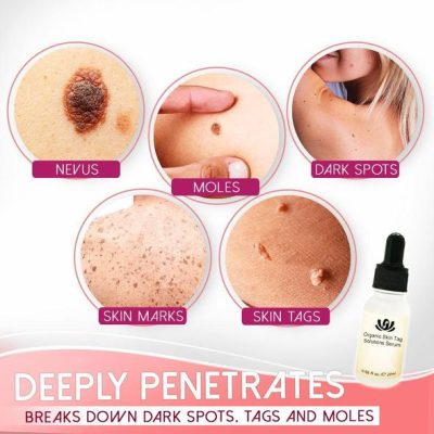 Organic Blemish Purifying Serum,Purifying Serum,Serum,Blemish,Organic
