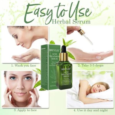 Herbal Serum,Acne Away,Serum