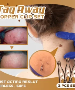 Tag Away Copper Clip Set