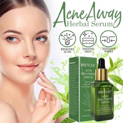 Herbal Serum,Acne Away,Serum