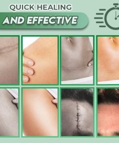 Reusable Surgery Scar Removal Silicone Gel,Surgery Scar Removal Silicone Gel,Scar Removal Silicone Gel,Scar Removal,Silicone Gel