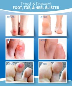 Hydrocolloid Healing Blister Plaster,Healing Blister Plaster,Blister Plaster,Hydrocolloid Healing Blister,Hydrocolloid Healing