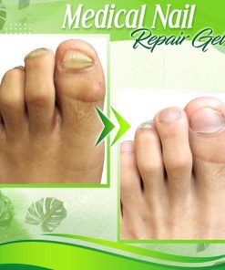 Toe Regeneration Beauty Gel,Regeneration Beauty Gel,Beauty Gel