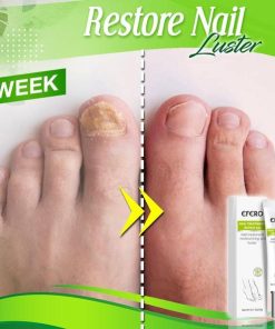 Toe Regeneration Beauty Gel,Regeneration Beauty Gel,Beauty Gel