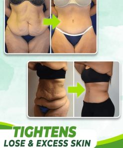 Flappy Skin Tightening Cream,Skin Tightening Cream,Tightening Cream,Flappy Skin