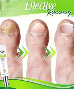 Toe Regeneration Beauty Gel,Regeneration Beauty Gel,Beauty Gel