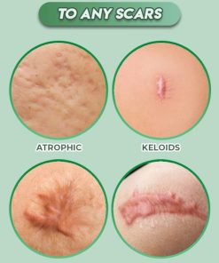 Reusable Surgery Scar Removal Silicone Gel,Surgery Scar Removal Silicone Gel,Scar Removal Silicone Gel,Scar Removal,Silicone Gel