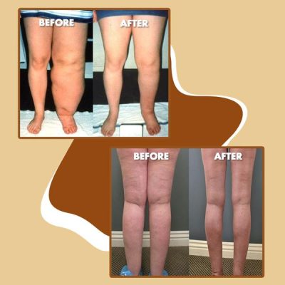 Essential Organic Ginger Oil,Organic Ginger Oil,Ginger Oil,Essential Organic Ginger,Organic Ginger