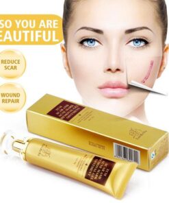Scar Remover Cream,Acne Scar Remover,Acne Scar,Remover Cream