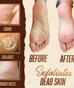 Herbal Foot Soak,Foot Soak,Herbal Foot,Anti-Fungal,Anti-Fungal Herbal Foot Soak