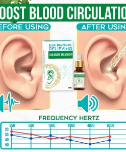 Ear Ringing Relieving Ear Drops Treatment,Ear Drops Treatment,Ear Ringing Relieving,Ear Ringing,Relieving Ear Drops