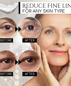 Electric Massager Eye Cream Collagen Serum,Electric Massager,Eye Cream Collagen Serum,Collagen Serum,Eye Cream