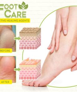 Fungal Reverse Herbal Treatment Foot Soak,Reverse Herbal Treatment Foot Soak,Herbal Treatment Foot Soak,Treatment Foot Soak,Foot Soak