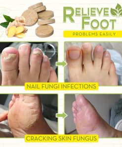 Fungal Reverse Herbal Treatment Foot Soak,Reverse Herbal Treatment Foot Soak,Herbal Treatment Foot Soak,Treatment Foot Soak,Foot Soak