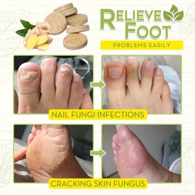 Fungal Reverse Herbal Treatment Foot Soak,Reverse Herbal Treatment Foot Soak,Herbal Treatment Foot Soak,Treatment Foot Soak,Foot Soak
