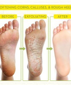 Fungal Reverse Herbal Treatment Foot Soak,Reverse Herbal Treatment Foot Soak,Herbal Treatment Foot Soak,Treatment Foot Soak,Foot Soak