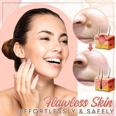 Herbal Wart Skin Removal Ointment,Skin Removal Ointment,Skin Removal,Herbal Wart,Removal Ointment