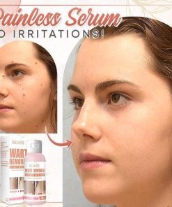 Herbal Wart Skin Removal Ointment,Skin Removal Ointment,Skin Removal,Herbal Wart,Removal Ointment