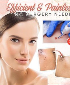 Herbal Wart Skin Removal Ointment,Skin Removal Ointment,Skin Removal,Herbal Wart,Removal Ointment