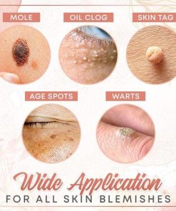 Herbal Wart Skin Removal Ointment,Skin Removal Ointment,Skin Removal,Herbal Wart,Removal Ointment