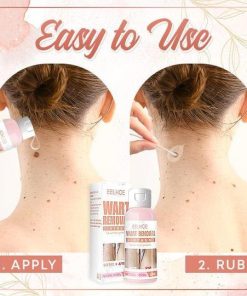 Herbal Wart Skin Removal Ointment,Skin Removal Ointment,Skin Removal,Herbal Wart,Removal Ointment