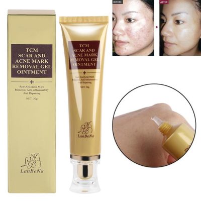 Scar Remover Cream,Acne Scar Remover,Acne Scar,Remover Cream