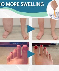 Anti-Swelling Acupressure Therapy Socks,Acupressure Therapy Socks,Therapy Socks,Acupressure Therapy,Anti-Swelling