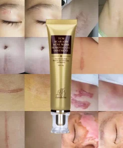 Scar Remover Cream,Acne Scar Remover,Acne Scar,Remover Cream