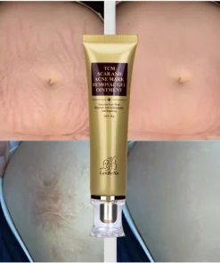 Scar Remover Cream,Acne Scar Remover,Acne Scar,Remover Cream
