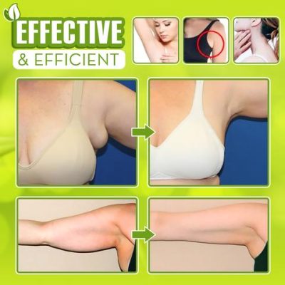 Herbal Ginger Lymph Patch,Ginger Lymph Patch,Lymph Patch