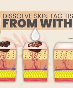 SpotOut Organic Purifying Serum,Organic Purifying Serum,Purifying Serum,Organic Purifying,SpotOut Organic