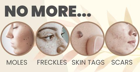 SpotOut Organic Purifying Serum,Organic Purifying Serum,Purifying Serum,Organic Purifying,SpotOut Organic