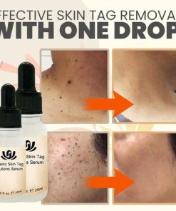 SpotOut Organic Purifying Serum,Organic Purifying Serum,Purifying Serum,Organic Purifying,SpotOut Organic