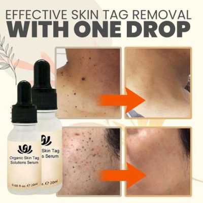 SpotOut Organic Purifying Serum,Organic Purifying Serum,Purifying Serum,Organic Purifying,SpotOut Organic